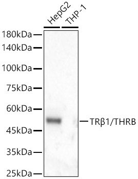 TRβ1/THRB Rabbit mAb