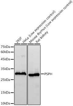 PSPH Rabbit mAb