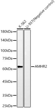 AMHR2 Rabbit mAb