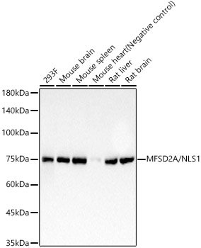 MFSD2A/NLS1 Rabbit mAb