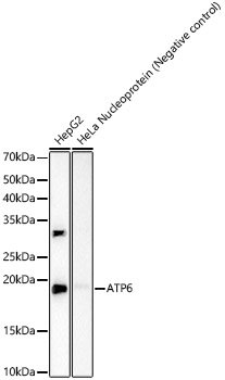 ATP6 Rabbit mAb