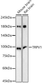 TRPV1 Rabbit mAb