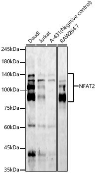 NFAT2 Rabbit mAb