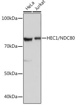 HEC1/NDC80 Rabbit mAb