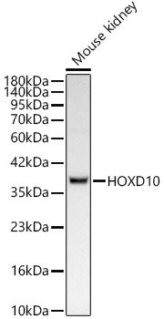 HOXD10 Rabbit mAb