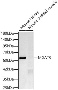 MGAT3 Rabbit mAb