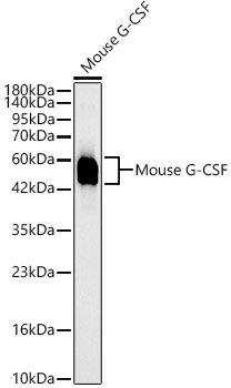 Mouse G-CSF Rabbit mAb