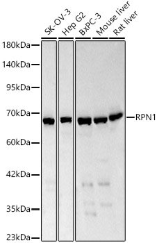 RPN1 Rabbit pAb