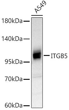 ITGB5 Rabbit pAb