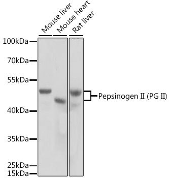 Pepsinogen II (PG II) Rabbit pAb