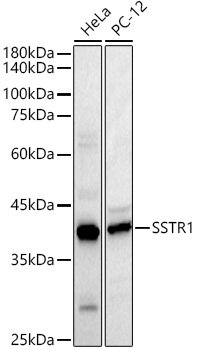 SSTR1 Rabbit pAb