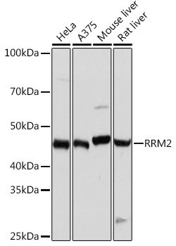 RRM2 Rabbit mAb