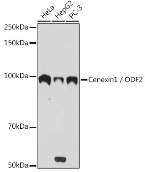 Cenexin1 / ODF2 Rabbit mAb