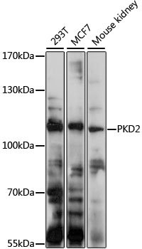 PKD2 Rabbit pAb