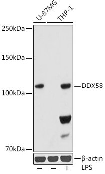 Rig-I/DDX58 Rabbit mAb