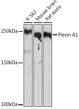 Plexin A1 Rabbit mAb