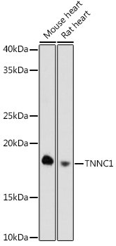 TNNC1 Rabbit mAb