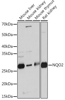 NQO2 Rabbit mAb
