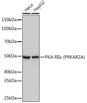 PKA RIIα (PRKAR2A) Rabbit mAb