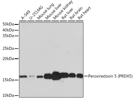 Peroxiredoxin 5 (PRDX5) Rabbit mAb