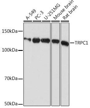 TRPC1 Rabbit mAb