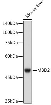 MBD2 Rabbit mAb