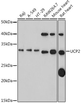 UCP2 Rabbit pAb