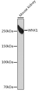 WNK1 Rabbit mAb