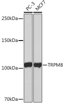 TRPM8 Rabbit mAb