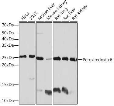 Peroxiredoxin 6 Rabbit mAb