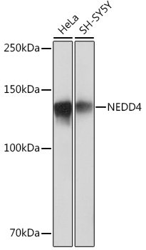 NEDD4 Rabbit mAb