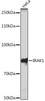 IRAK1 Rabbit mAb