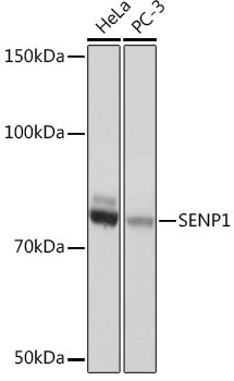 SENP1 Rabbit mAb