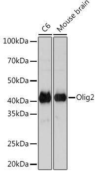 Olig2 Rabbit mAb