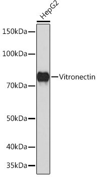 Vitronectin Rabbit mAb