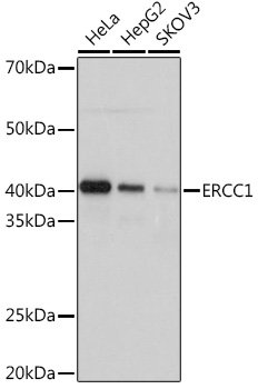 ERCC1 Rabbit mAb