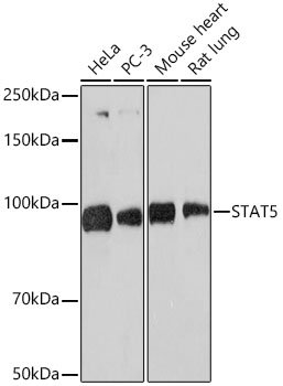 STAT5 Rabbit mAb