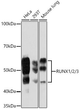 RUNX1/2/3 Rabbit mAb