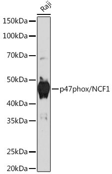 p47phox/NCF1 Rabbit mAb