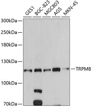 TRPM8 Rabbit pAb