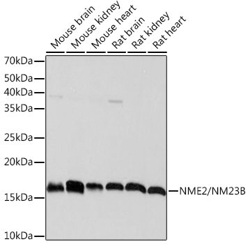 NME2/NM23B Rabbit mAb