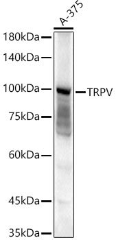 TRPV4 Rabbit pAb