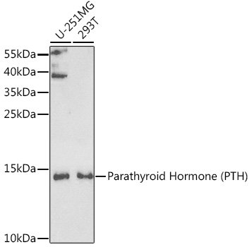 Parathyroid Hormone (PTH) Rabbit pAb