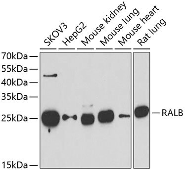 RALB Rabbit pAb