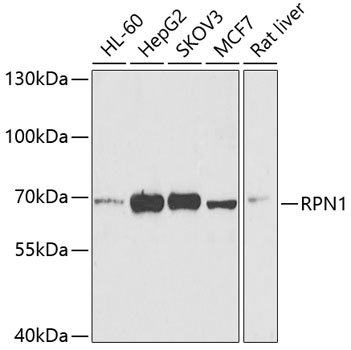 RPN1 Rabbit pAb