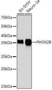 PHOX2B Rabbit mAb