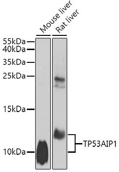 TP53AIP1 Rabbit pAb