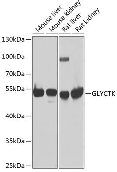 GLYCTK Rabbit pAb