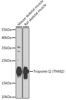 Troponin I2 (TNNI2) Rabbit pAb