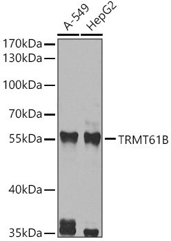 TRMT61B Rabbit pAb